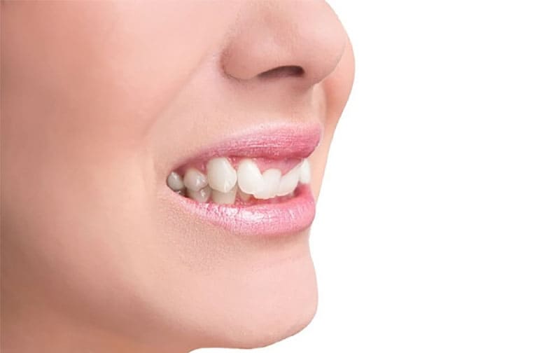 دیپ بایت چیست ؟